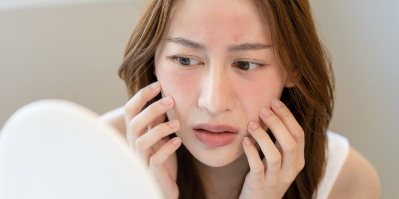 Water and Acne: What You Need to Know in Plain Language